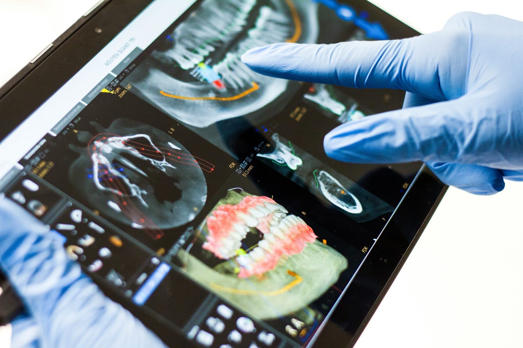 Reviewing a digital dental scan on a tablet
